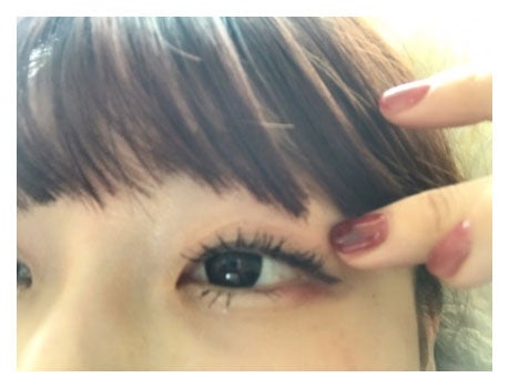 上まぶたに“できもの”が出来てしまったいう桃の目／桃オフィシャルブログ（Ameba）より