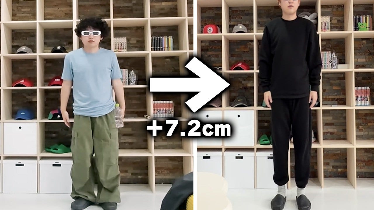 1000万円で身長を7センチ買った！？海外で骨延長手術を受けたYouTuberが話題に
