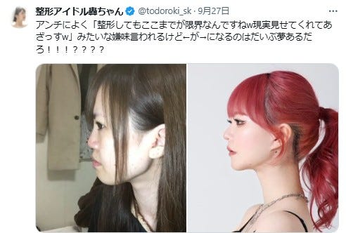 整形アイドル轟ちゃん公式Xより