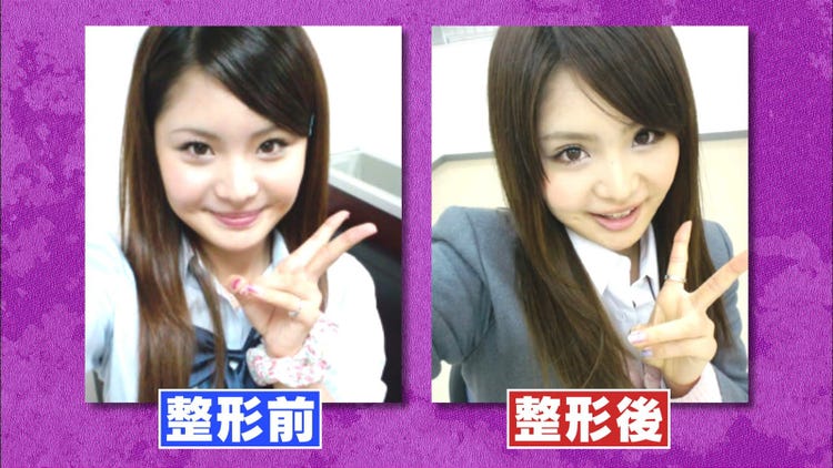 元 女子高生演歌歌手 整形をカミングアウト 元ギャル 結婚 子持ち 初告白の連続 歌恋 モデルプレス 元 女子高生演歌歌手 整形をカミングアウト 元ギャル 結婚 子持ち 初告白の連続 歌恋 モデルプレス