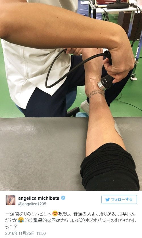 画像1 2 複雑骨折の道端アンジェリカ 驚異的 回復力に驚き モデルプレス 画像1 2 複雑骨折の道端アンジェリカ 驚異的 回復力に驚き モデルプレス