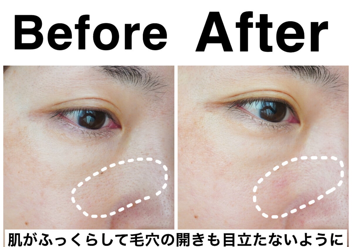 ハリと毛穴が気になる美容ライターが10日間実際に使ってみた！人気美容液の正直レビュー