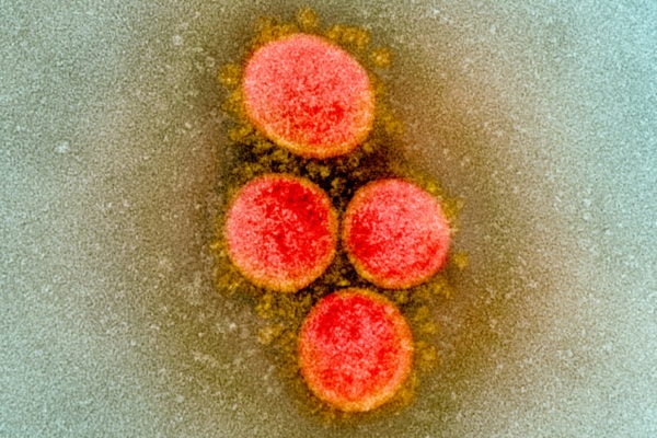 東京都、22日の新規感染者は1175人 重症者は158人に