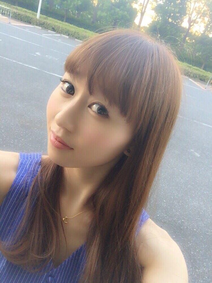 2015年ボトックス、ヒアルロン酸など注入系(画像提供:所属事務所)