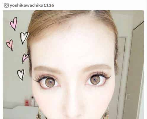 整形公表の双子モデル・吉川ちか、手術前の胸中告白「こわい」