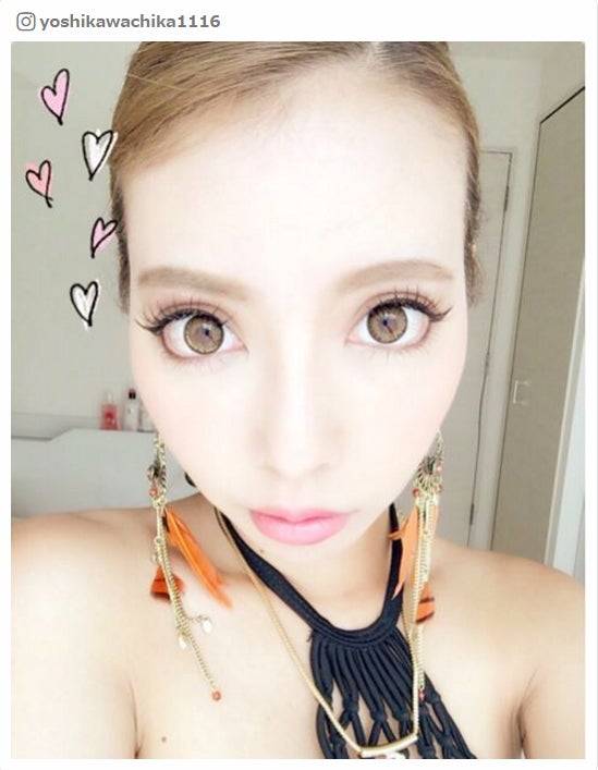 整形公表の双子モデル 吉川ちか 手術前の胸中告白 こわい モデルプレス 整形公表の双子モデル 吉川ちか 手術前の胸中告白 こわい モデルプレス