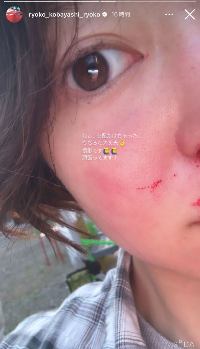 小林涼子 Instagramストーリーズより