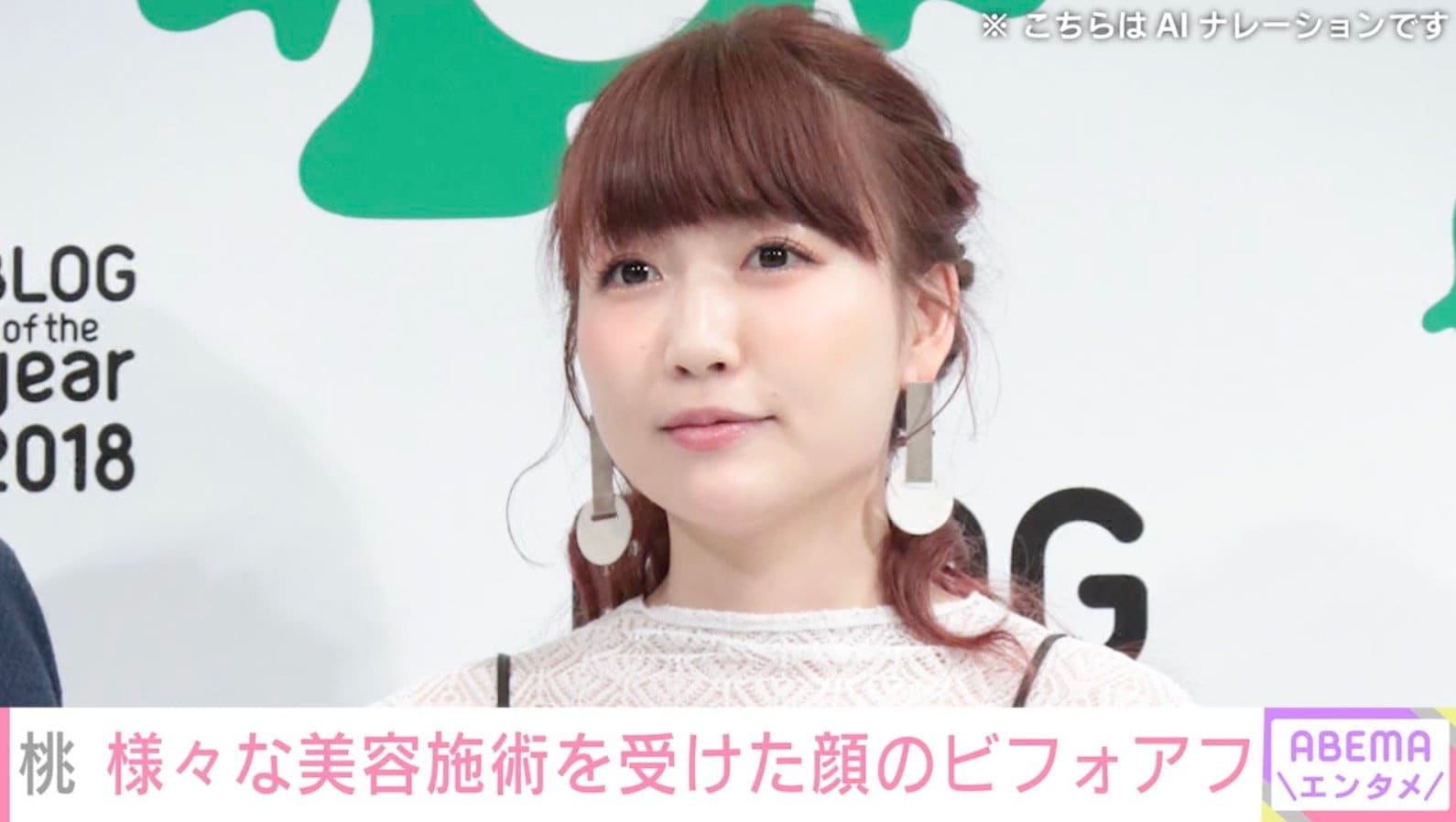 “3度の二重施術”桃、目元の美容施術のビフォーアフターを公開