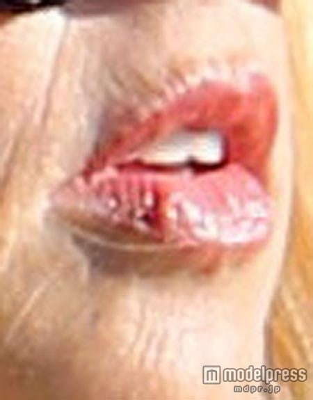 痛そうな唇……。x17online.com / Zeta Image