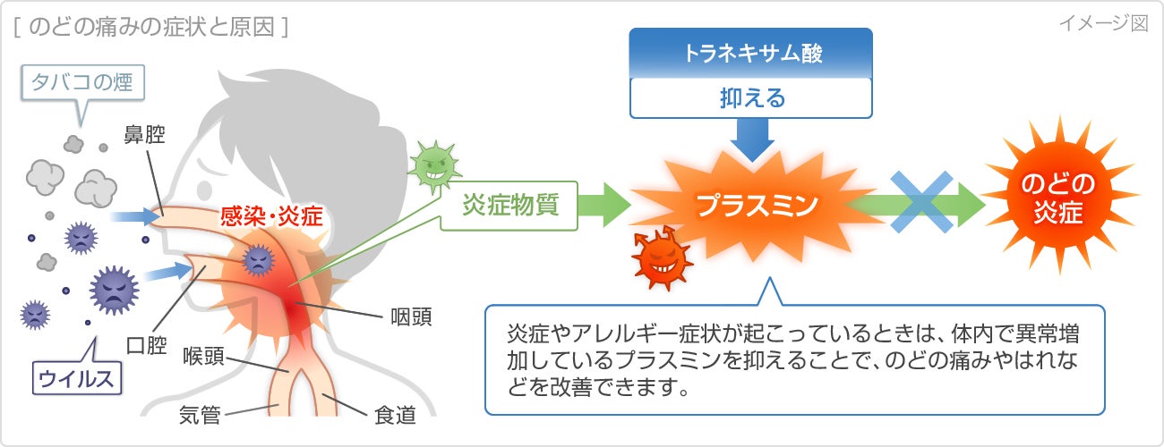 トラネキサム酸がのどの痛みや炎症を抑えるイメージ図　※出典：くすりと健康の情報局（一部改変）
