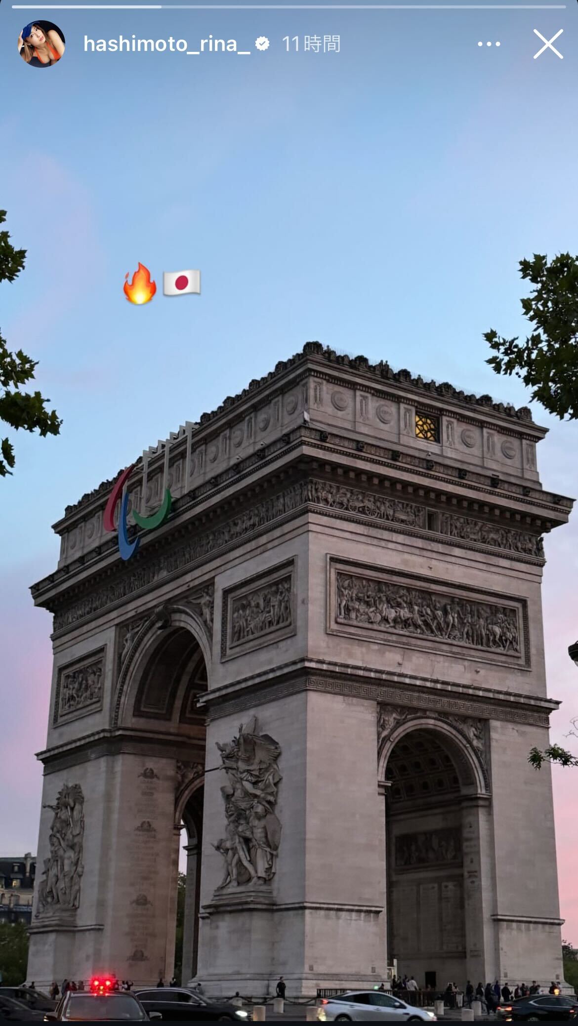 橋本梨菜Instagramストーリーズより