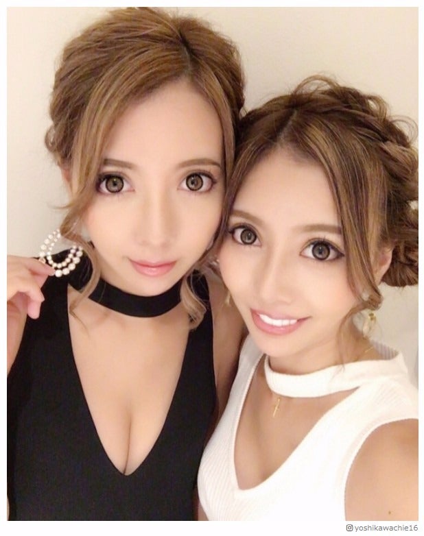 人気双子モデル・吉川ちえ＆ちか、そろって整形手術再び「顎がはえたよん」