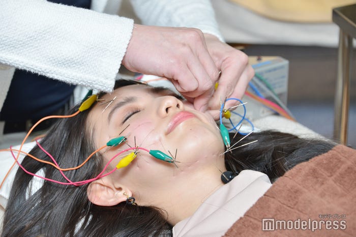 鍼灸施術を受ける黒木麗奈 (C)モデルプレス