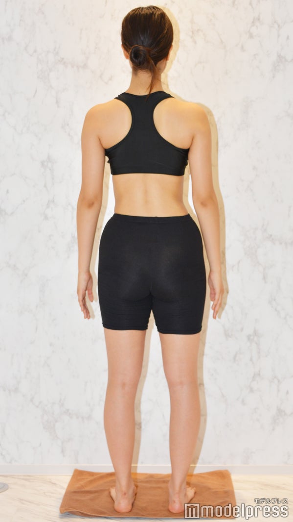 1ヶ月の施術後（C）モデルプレス