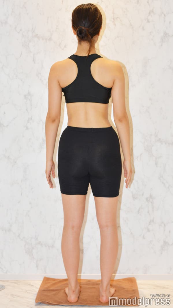 1ヶ月の施術後(C)モデルプレス