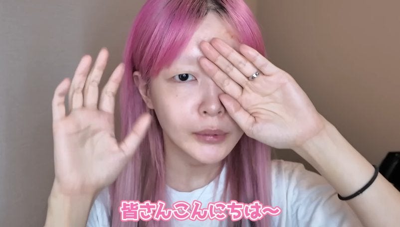 顔面負傷のハウスダスト、撮影を決意させたマネージャーの一言とは？