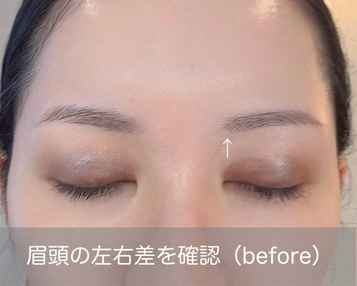 眉頭の左右差を確認　before