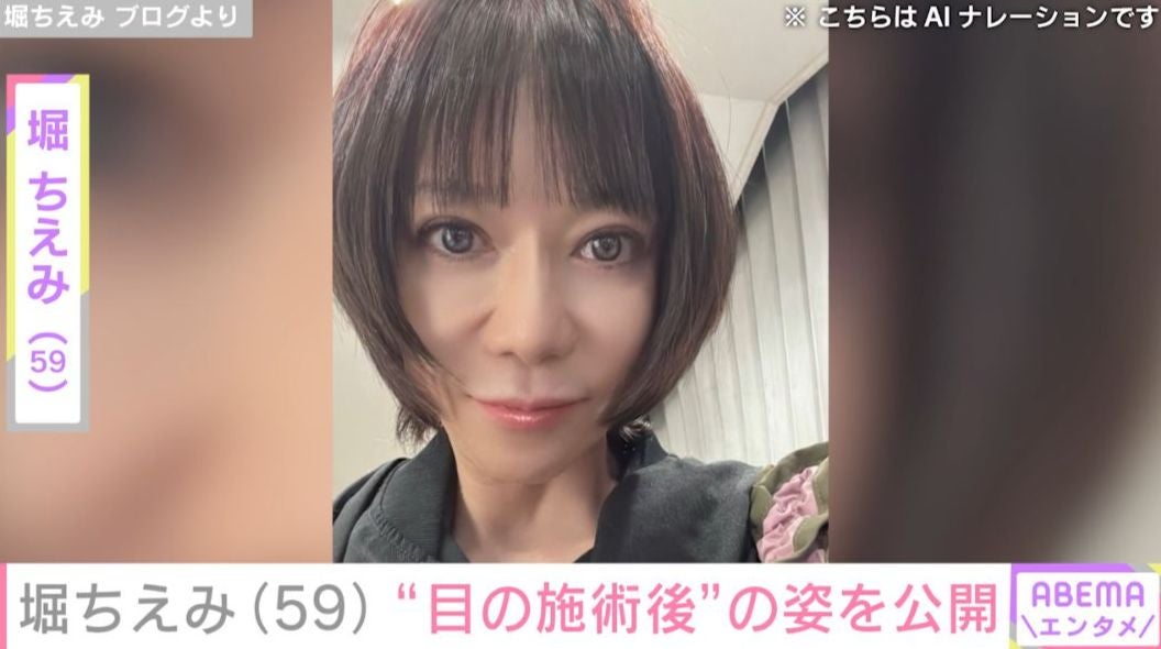 堀ちえみ（59）、“目の施術後”の自撮りショットに反響 「とっても印象的なお目々」「セクシー可愛い」