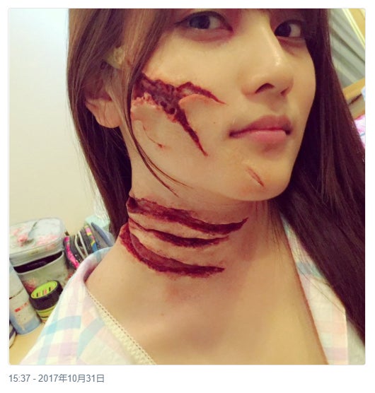 AKB48入山杏奈、痛々しい姿に「びっくりした」の声