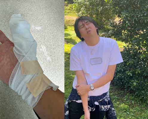 人気YouTuberきまぐれクック、人生初骨折を報告「大事な商売道具にヒビが」