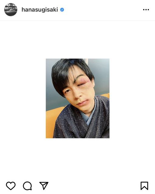 成田凌の顔面がボコボコに 杉咲花が公開した衝撃のオフショットに反響 痛々しい すっごいリアル モデルプレス 成田凌の顔面がボコボコに 杉咲花が公開した衝撃のオフショットに反響 痛々しい すっごいリアル モデルプレス