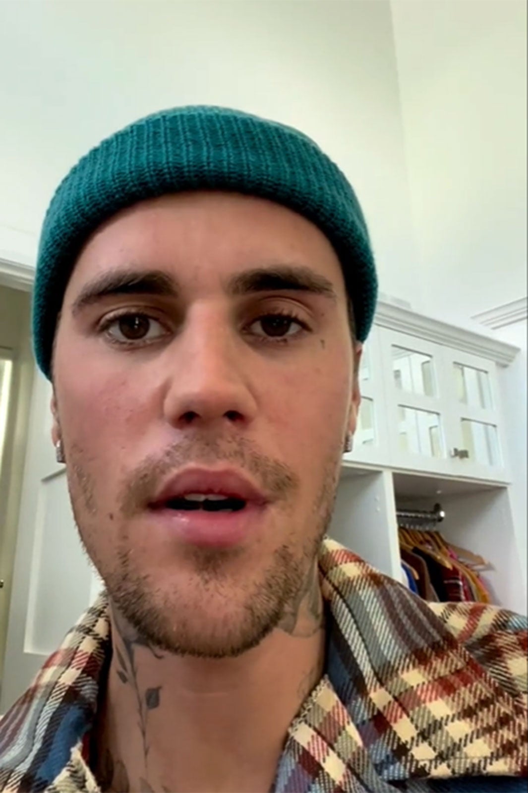 ジャスティン・ビーバー、顔面麻痺で休養発表