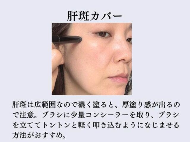 肝斑カバー　解説