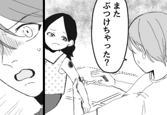【幼い娘の身体に増え続けるアザ…！？】医師の指摘を受け、夫に相談すると⇒「…私のせい？」返答に血の気が引いたワケ