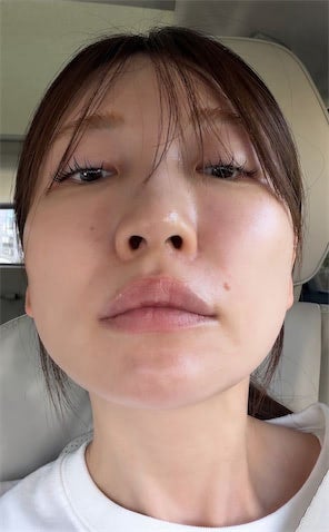 あいのり・桃、顔の片側だけ美顔器で"ポスポス" 衝撃のビフォーアフター披露「すごくない？！」