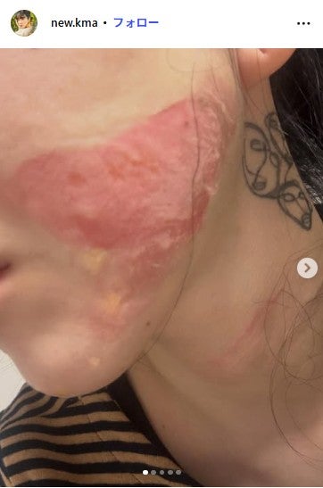 クォン・ミナInstagramより