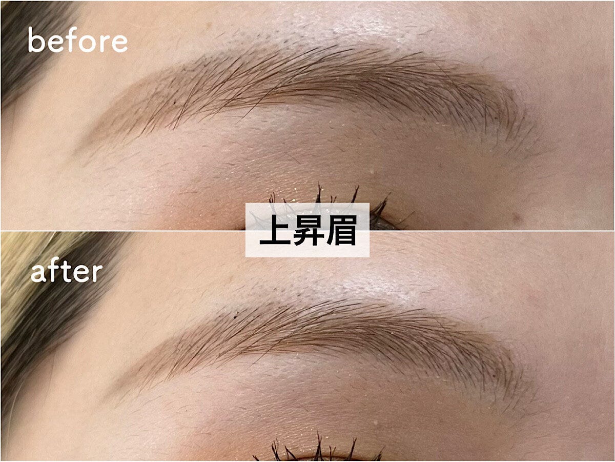 上昇眉beforeafter