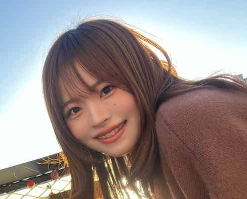 YouTuberになに、歯列矯正ビフォーアフター公開「どれだけ重要か痛い程伝わる写真」