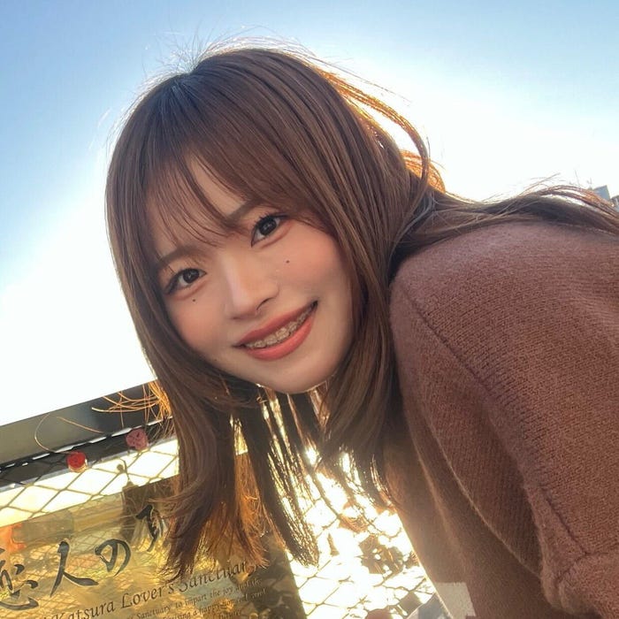 YouTuberになに、歯列矯正ビフォーアフター公開「どれだけ重要か痛い程伝わる写真」 - モデルプレス