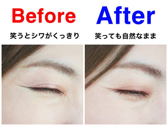 Before　After　比較