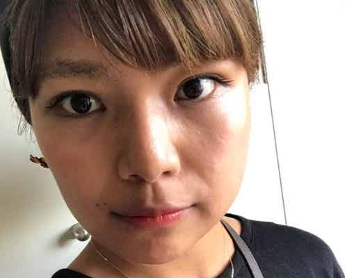 整形公表の「あいのり」クロ、3日目の経過を報告