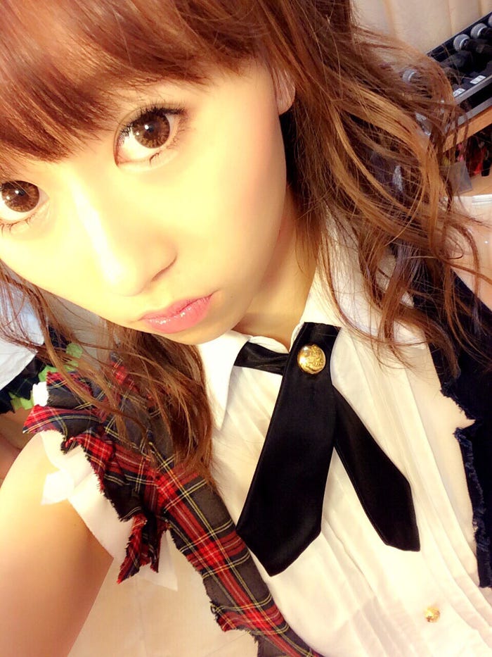 2014年目整形、1回目失敗してやり直し(画像提供:所属事務所)