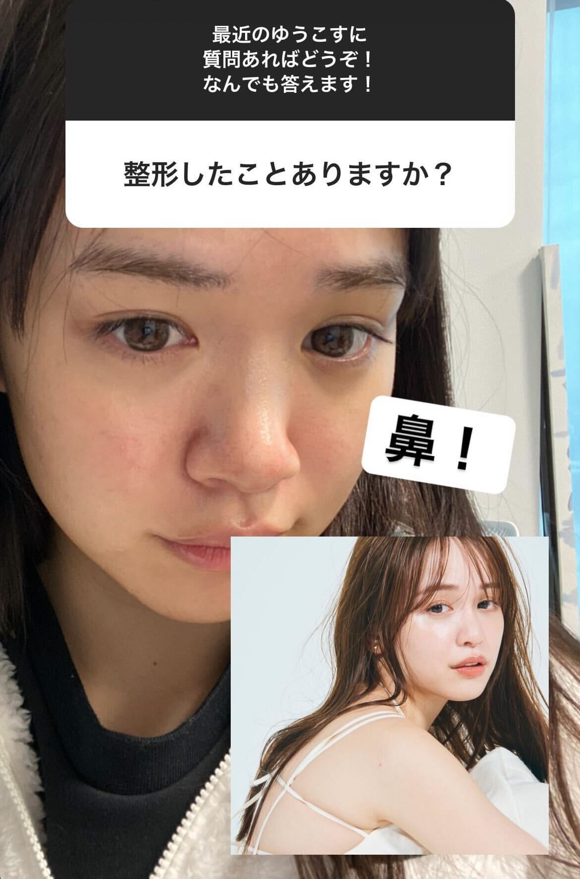 ゆうこすInstagramストーリーズより