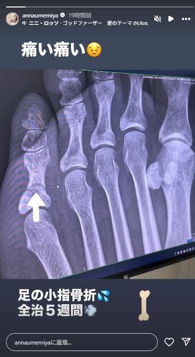 梅宮アンナ Instagramより