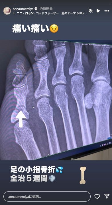 梅宮アンナ Instagramより