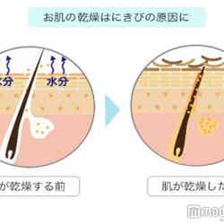 大人ニキビの原因は、肌の乾燥が引き起こす毛穴詰まり