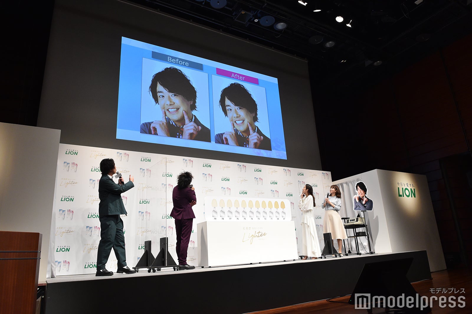 シュウペイのビフォーアフター （C）モデルプレス