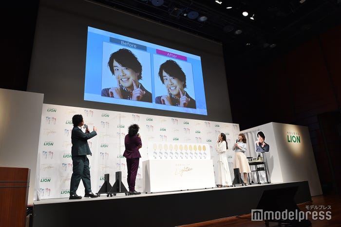 シュウペイのビフォーアフター (C)モデルプレス