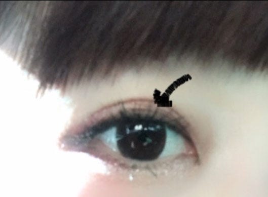 一重の線が出現した二重整形手術後の桃の目/桃オフィシャルブログ(Ameba)より