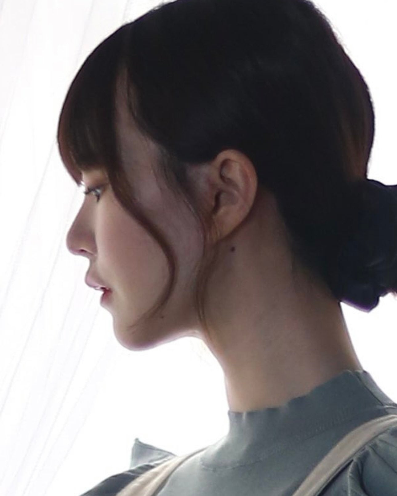 “総額1350万”整形アイドル轟ちゃん、横顔のビフォーアフター公開「さらに綺麗になってる」「垢抜けが凄い」と反響続々