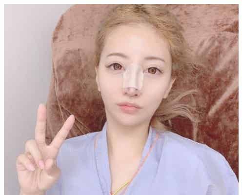 双子モデル・吉川ちえ、鼻の整形手術を報告 整形総額は700万超に
