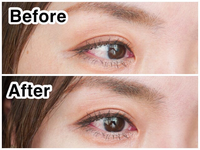 ノーズシャドウbeforeafter