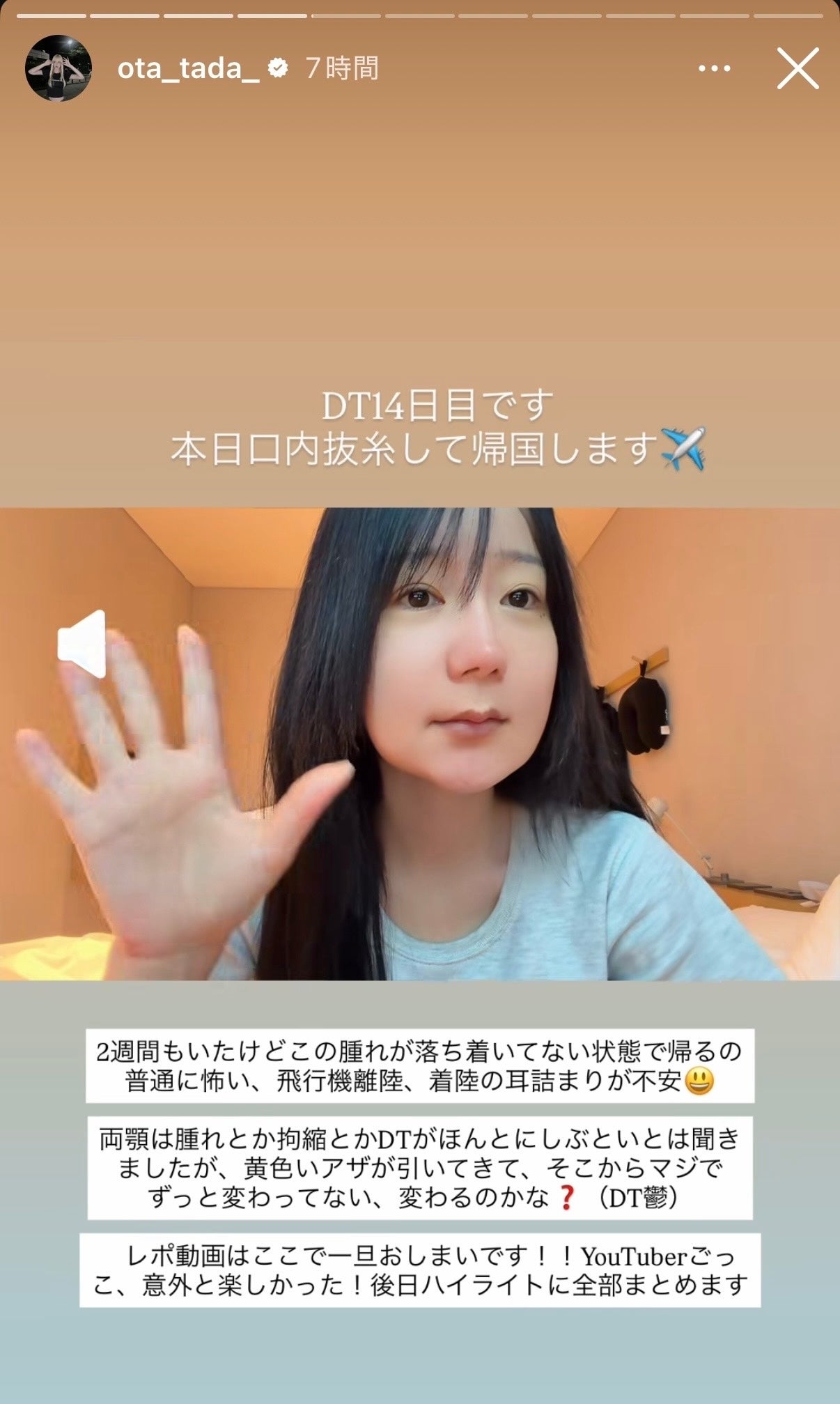 多田さんInstagramストーリーズより