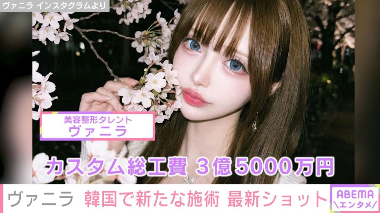 “カスタム総工費3億超” ヴァニラ、新たな施術を公表 最新ショットに「きょうも美しい」など反響