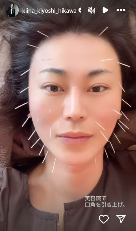 氷川きよしInstagramストーリーズより