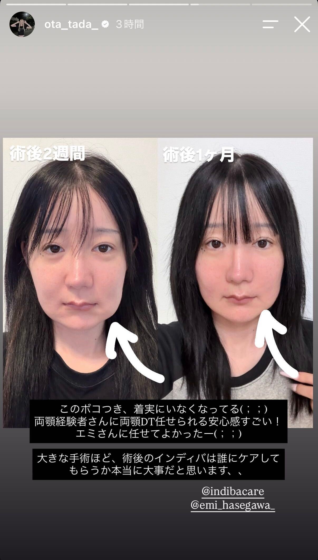 多田さんInstagramストーリーズより